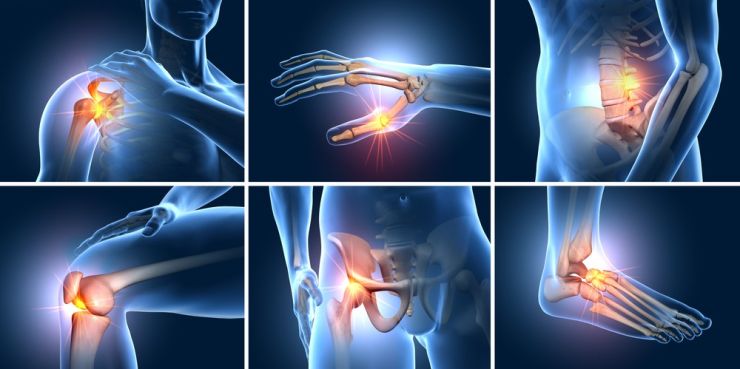 Mga Alternatibong Lunas para sa Osteoarthritis